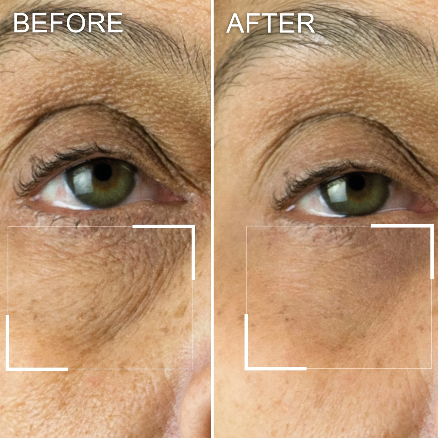 Celestica™ Collagen Infusion Tightening Eye Patches (10 Pairs)