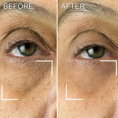 Celestica™ Collagen Infusion Tightening Eye Patches (10 Pairs)